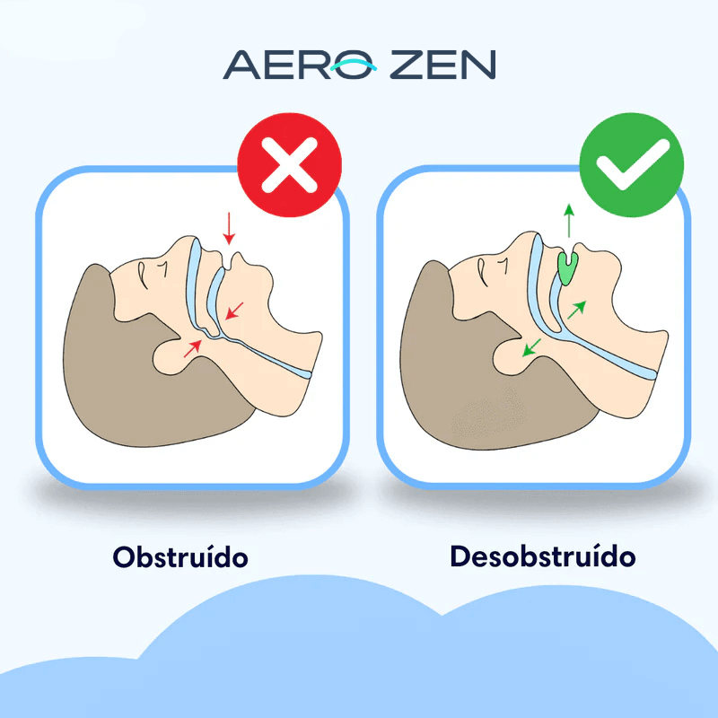 AeroSleep PRO - Aparelho Anti Ronco Bucal